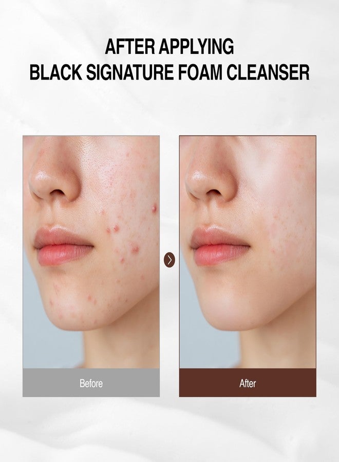 Ottie Black Signature Foam Cleanser 4.05 fl oz | facial cleanser, facewash, hydrating face wash, makeup remover, pore cleaner, foaming face wash, cleanser, travel face wash, face cleanser for women - Image 3